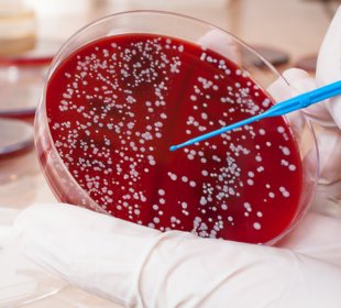 New hope for blood cancer sufferers to discover a matching blood stem mobile donor 3