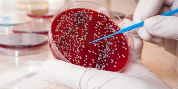 New hope for blood cancer sufferers to discover a matching blood stem mobile donor 12