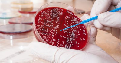 New hope for blood cancer sufferers to discover a matching blood stem mobile donor 5