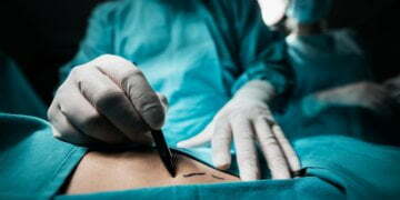 The 19 Things I Always Recommend to Someone Having Breast-Cancer Surgery 10
