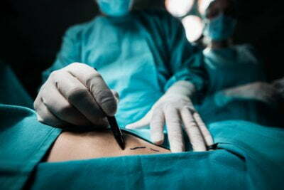 The 19 Things I Always Recommend to Someone Having Breast-Cancer Surgery 7