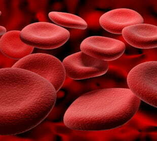 Caron Myers: Help blood cancer sufferers win race against time – skip the PACT Act 1