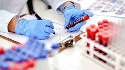 Clinical calculator ought to spare breast cancer sufferers 5 years 8