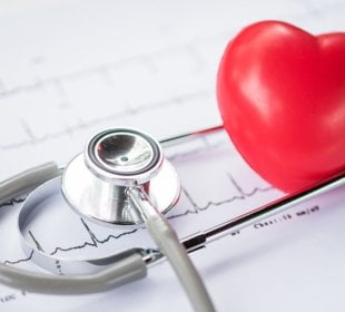 Strength training tied to higher coronary heart health than aerobic 1