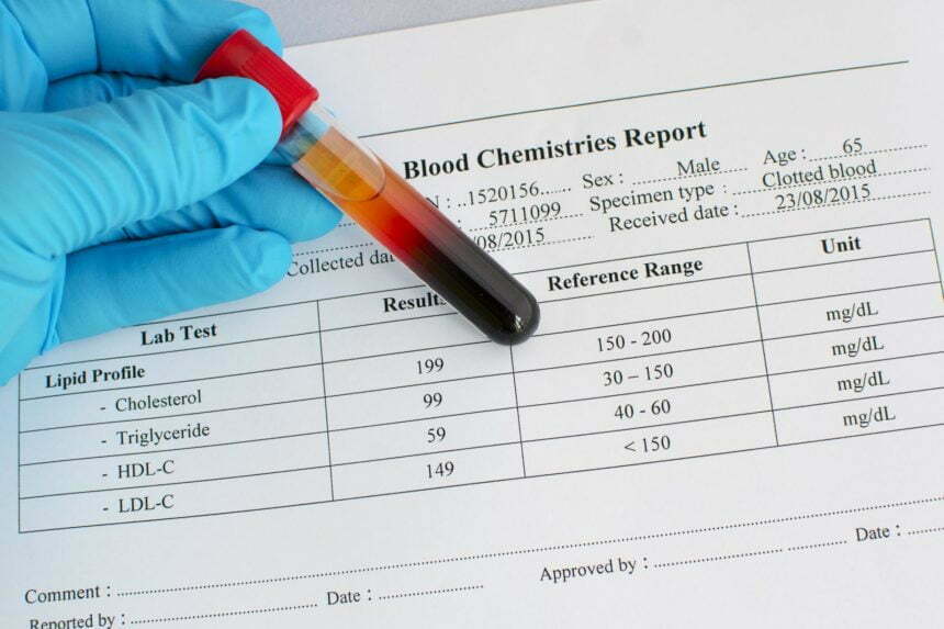 Aggressive cholesterol decreasing may make contributions 6