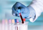 Liquid biopsies: the future of cancer prognosis? 2