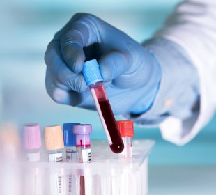 Liquid biopsies: the future of cancer prognosis? 6
