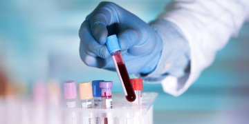 Liquid biopsies: the future of cancer prognosis? 11