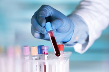 Liquid biopsies: the future of cancer prognosis? 1