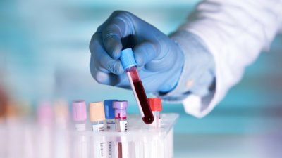 Liquid biopsies: the future of cancer prognosis? 8
