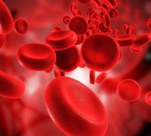 Why Do People Get Blood Cancer? 7