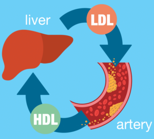 High Ldl Cholesterol - How to Treat It 4