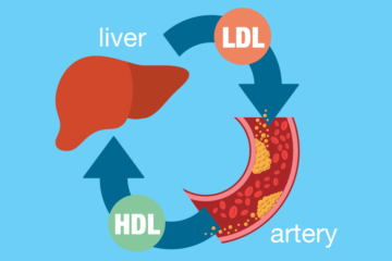 High Ldl Cholesterol - How to Treat It 18