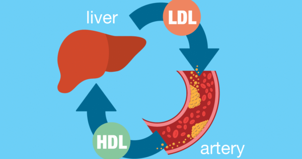 High Ldl Cholesterol - How to Treat It 1