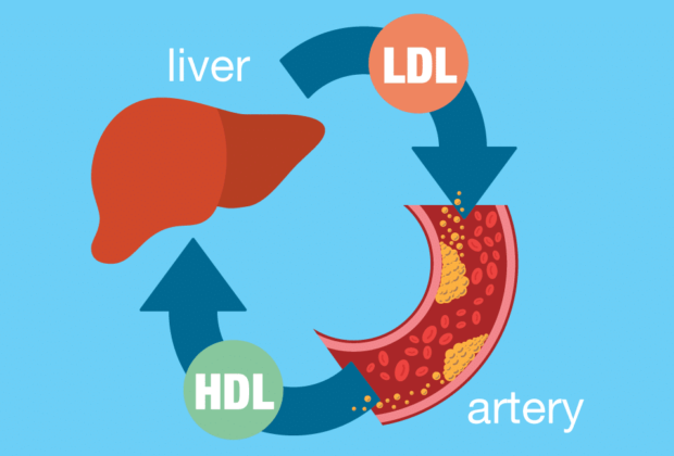 High Ldl Cholesterol - How to Treat It 1