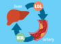 High Ldl Cholesterol - How to Treat It 6