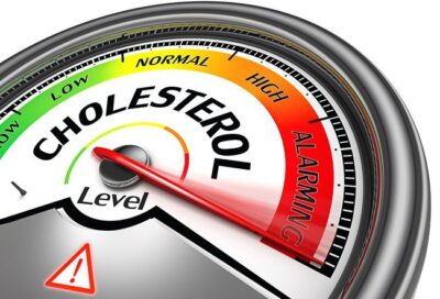 The Truth About Normal Cholesterol Levels 7