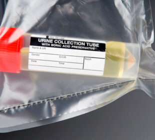 The Best Drug Test Urine Results Software 6