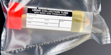 The Best Drug Test Urine Results Software 17