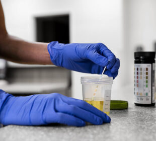 Does dot physical require a drug test? 10