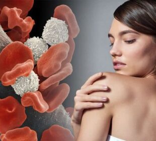 What is the Difference Between a Blood Cancer and Leukemia? 10