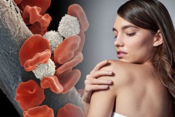 What is the Difference Between a Blood Cancer and Leukemia? 1