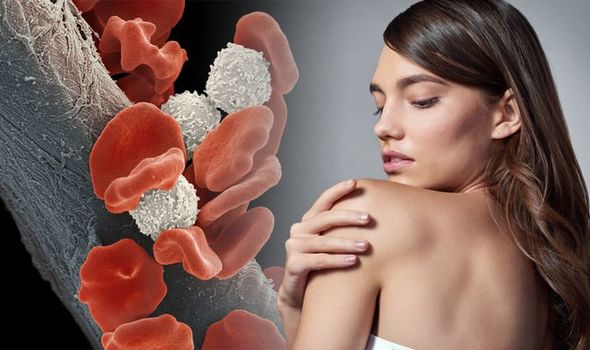What is the Difference Between a Blood Cancer and Leukemia? 21