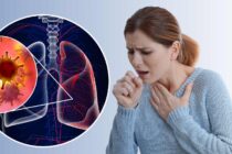 Lung Cancer on Chest X-Ray: What to Look For 3
