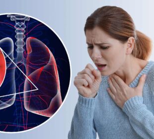 Lung Cancer on Chest X-Ray: What to Look For 5