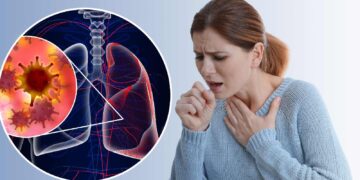 Lung Cancer on Chest X-Ray: What to Look For 11