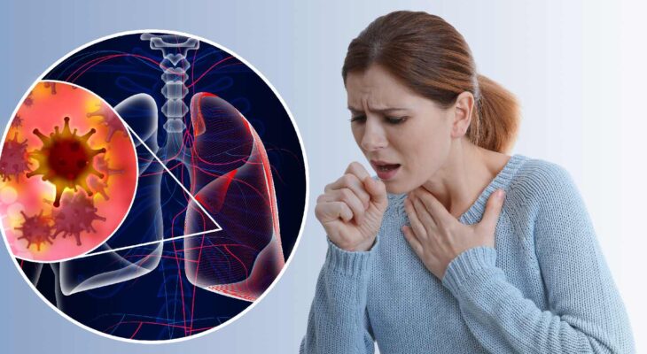 Lung Cancer on Chest X-Ray: What to Look For 16