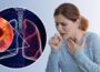 Lung Cancer on Chest X-Ray: What to Look For 6
