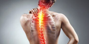 Creating India's largest back ache facts bank 29