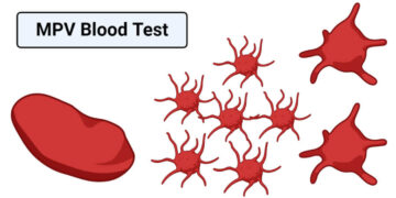 Understanding the MPV Blood Test: What You Need to Know 15