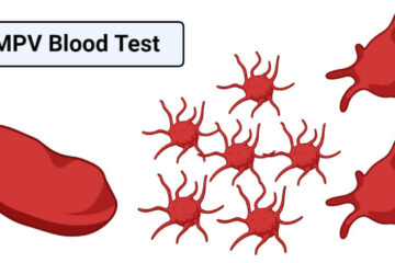 Understanding the MPV Blood Test: What You Need to Know 1